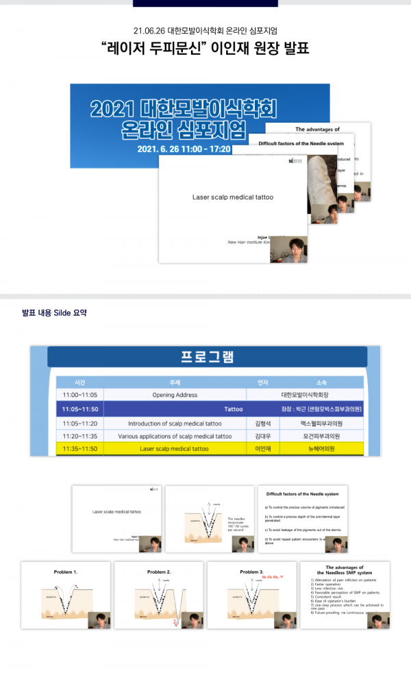 뉴헤어의원 - 210626 대한모발이식학회 온라인 심포지엄 이인재 원장 발표