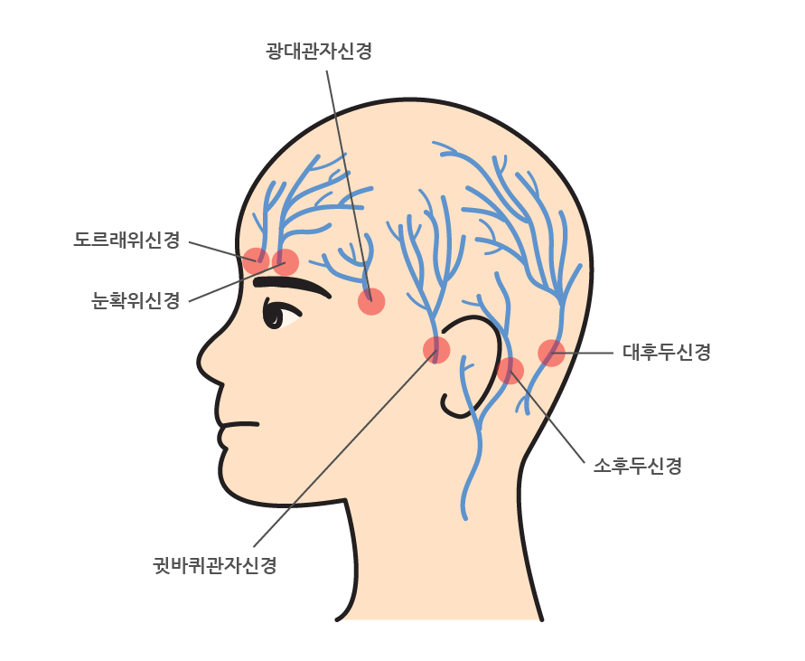 모발_이식_두피 신경