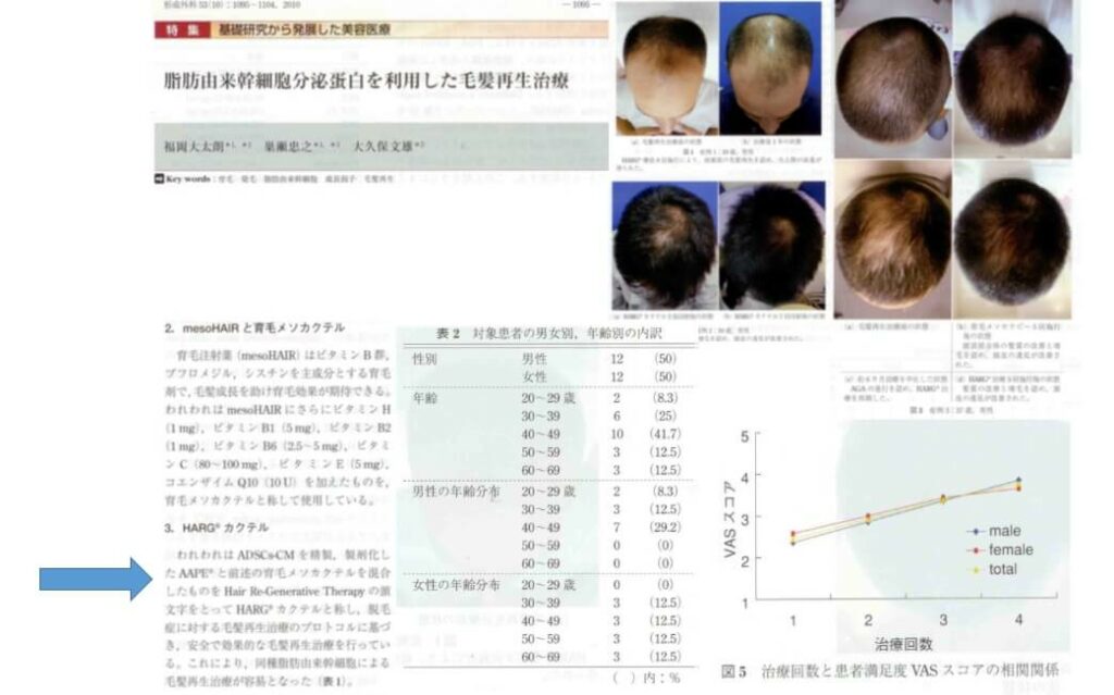 일본 엑소좀 연구들