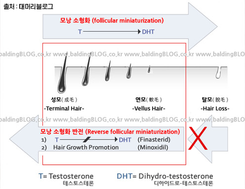 DHT_뉴헤어의원_inewhair