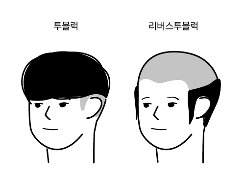 리버스투블럭_뉴헤어모발성형외과_inewhair