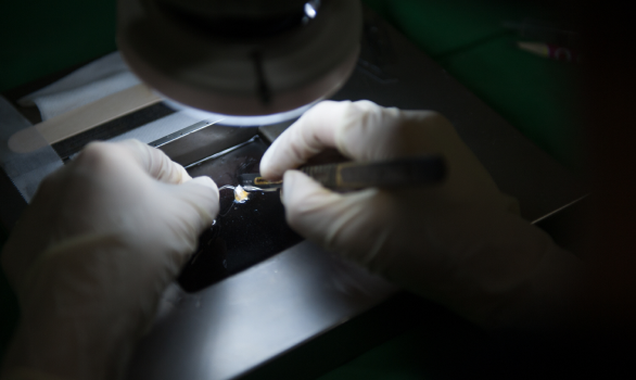 모낭수분유지장치(아쿠아커팅)