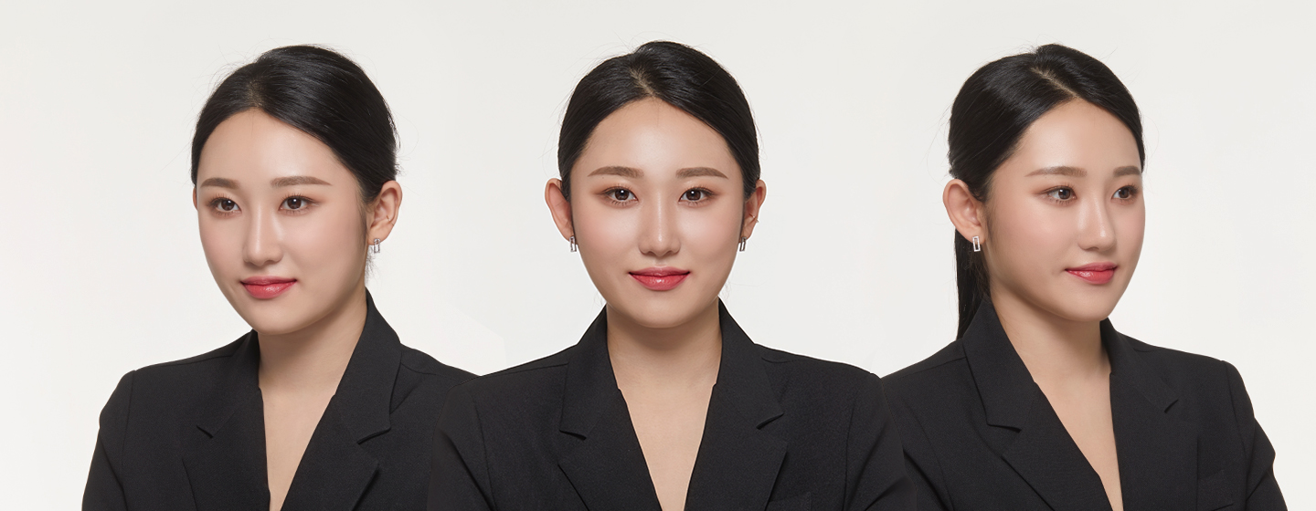 이마 축소 헤어라인교정