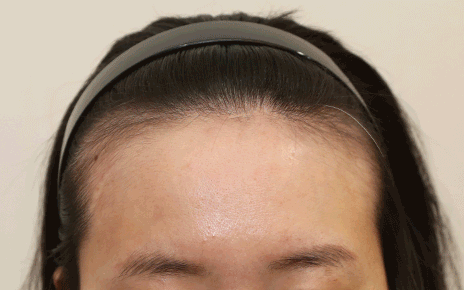 얼굴형, 헤어라인에 구애 없이 완성하는 맞춤형 라인