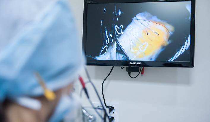 고배율 디지털 현미경 분리